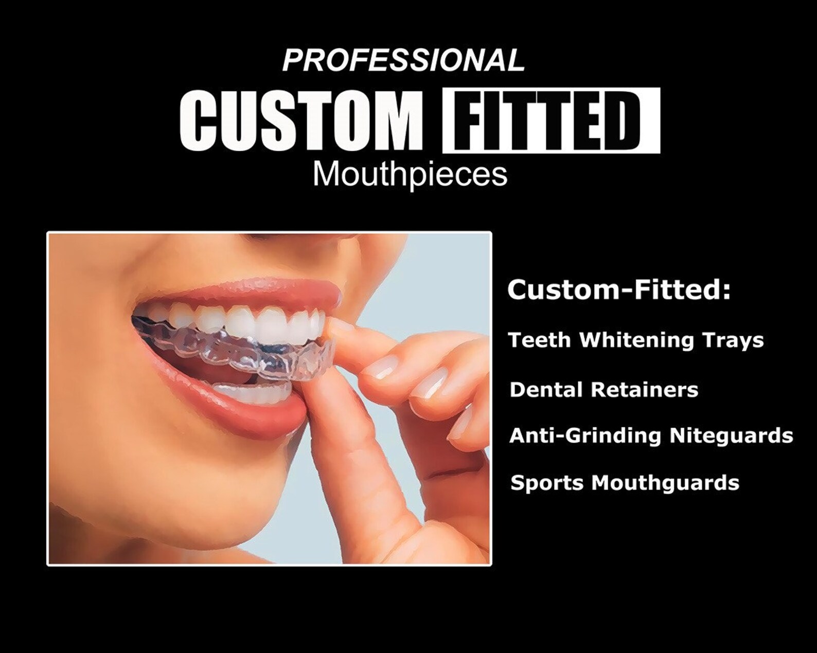Teeth Whitening Trays Upper and Lower Custom Set Etsy