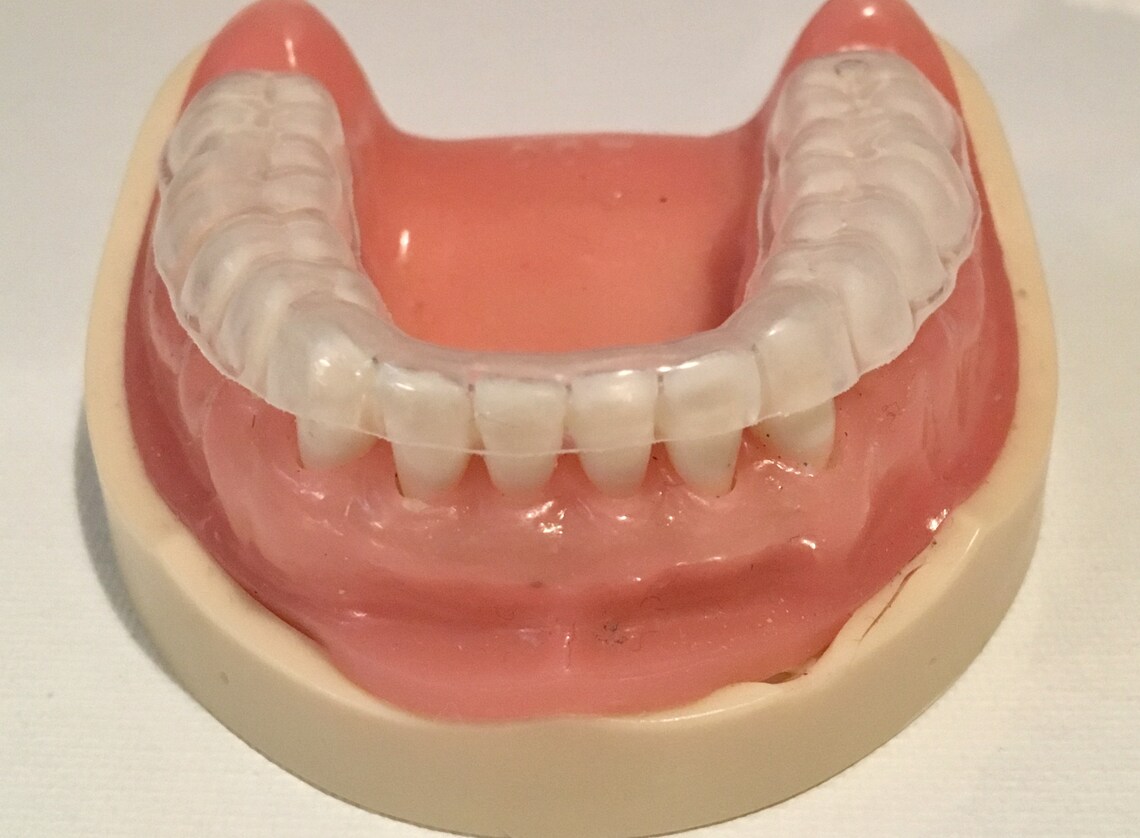 Night Guard Premium Professional Custom Fitted Free Shipping Etsy