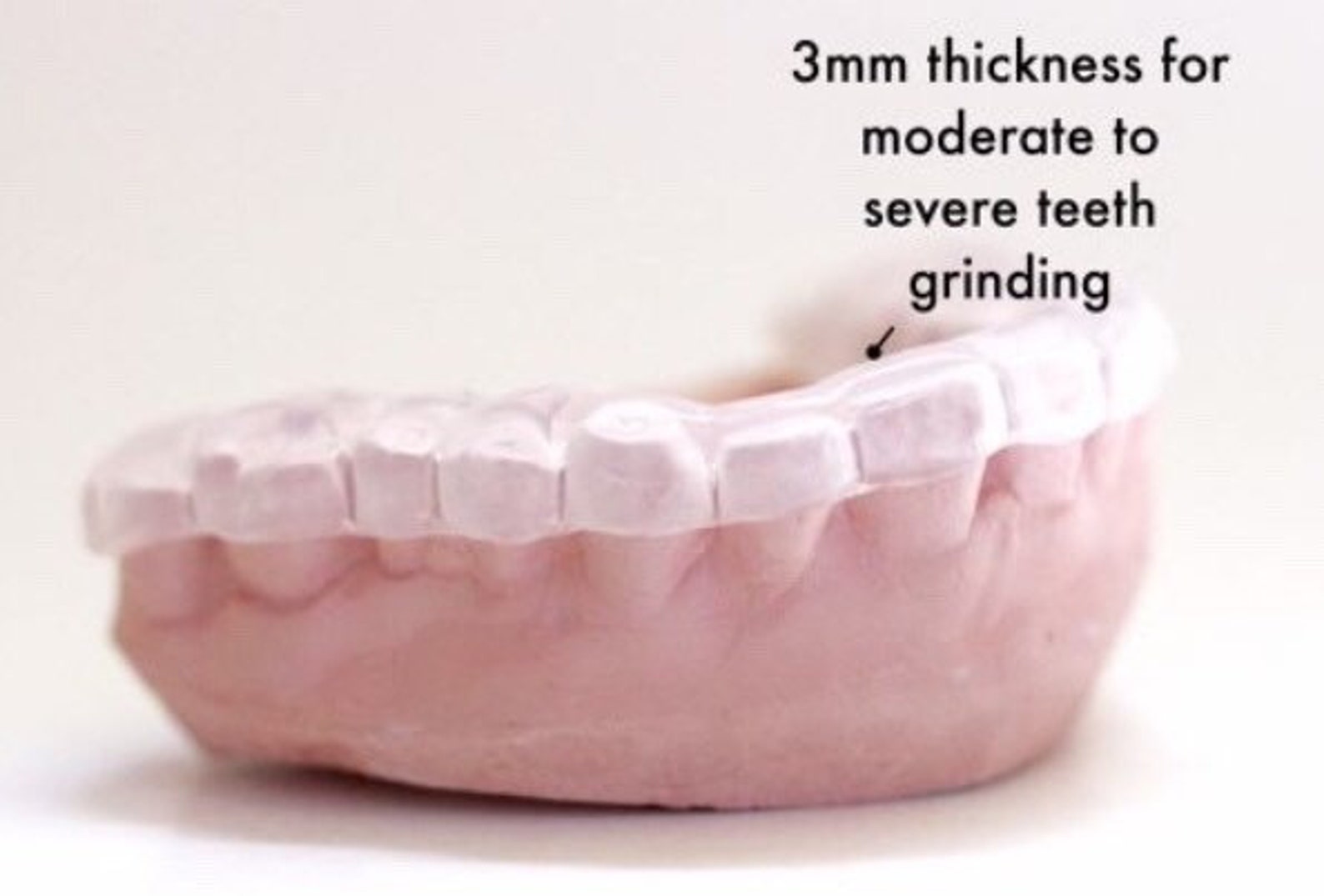 Night Guard Premium Professional Custom Fitted Free Shipping Etsy