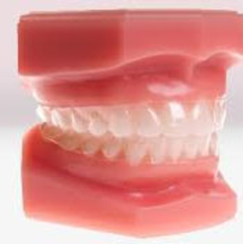 Custom Fit Orthodontic Retainers Etsy