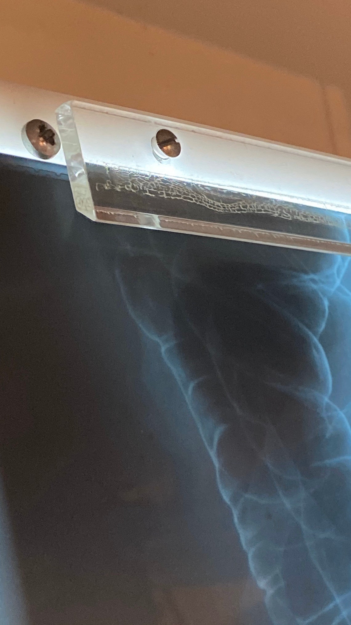 Wall mounted vintage Xray light box. 8 lights. Great upcycle Etsy