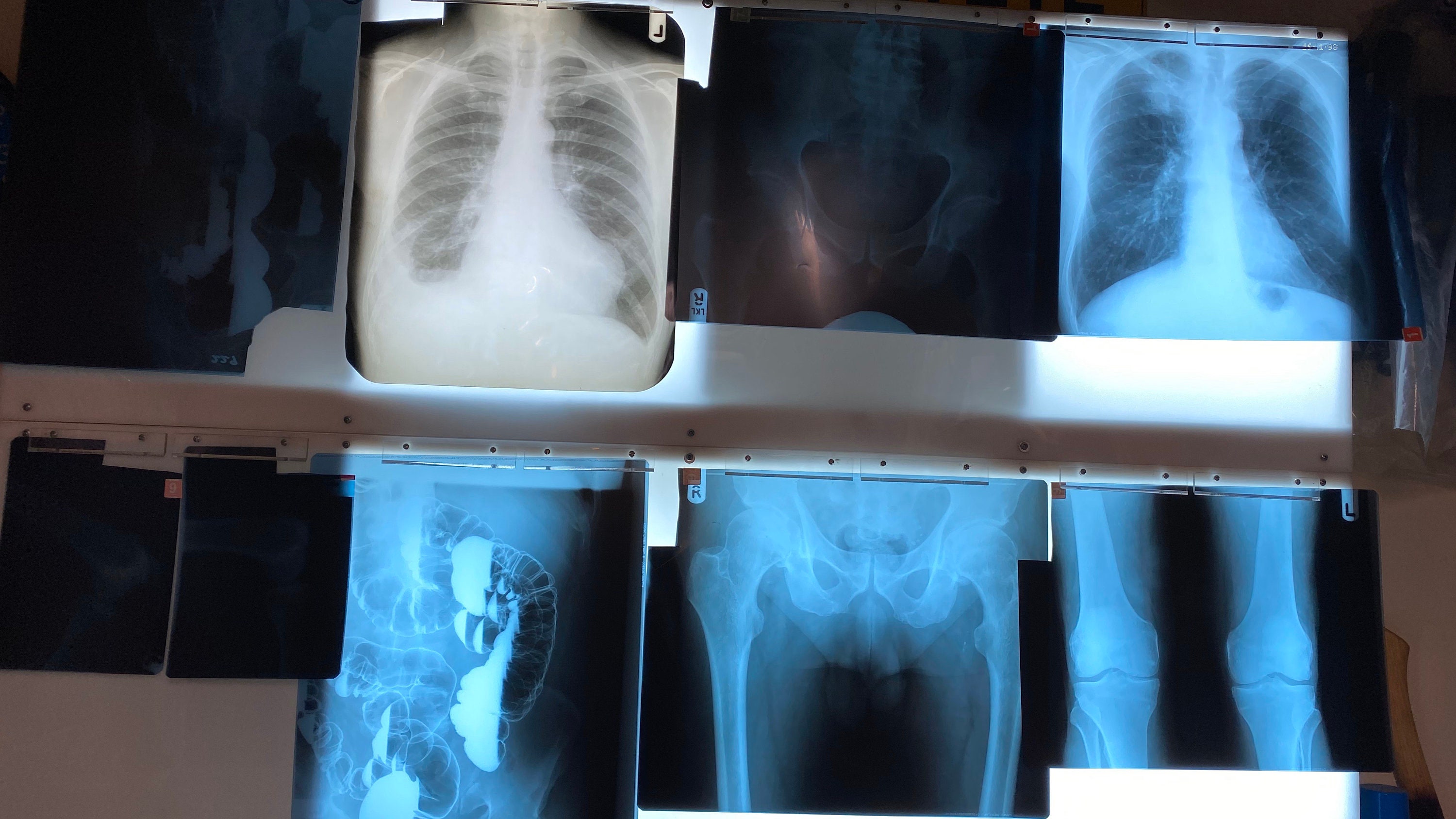 Wall mounted vintage Xray light box. 8 lights. Great upcycle Etsy