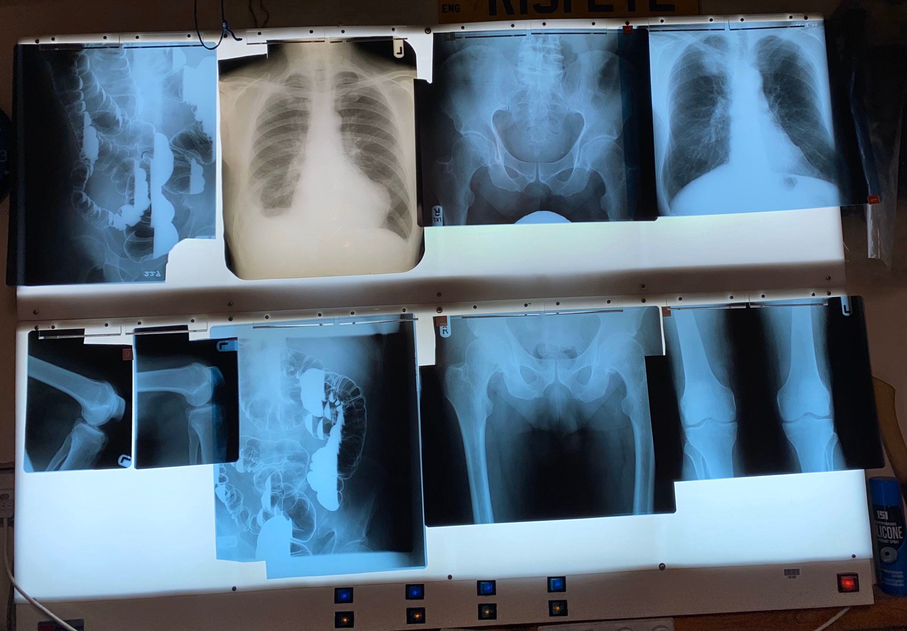 Wall mounted vintage Xray light box. 8 lights. Great upcycle Etsy