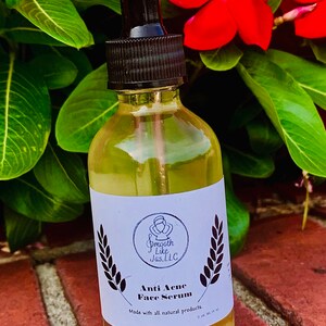 K&ouml;nnte beinhalten: Eine durchsichtige Glasflasche mit schwarzem Tropfer und einem wei&szlig;en Etikett. Das Etikett tr&auml;gt ein Logo mit dem Text "Smooth Like Jas, LLC" und die Worte "Anti Acne Face Serum" mit dem Text "Hergestellt mit nat&uuml;rlichen Produkten. 2 oz (59,14 ml)".