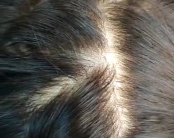 Puede incluir: Primer plano del cuero cabelludo de una persona con cabello castaño oscuro. El cabello está dividido en el medio y el cuero cabelludo es visible.