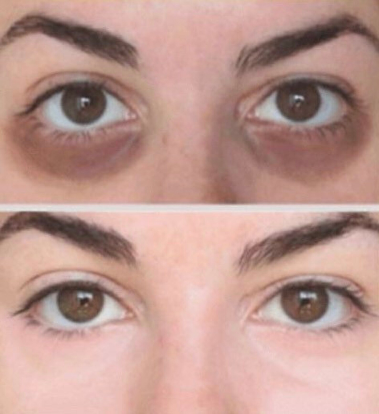 Under Eye Serum, Dark Circle Eraser, Antiwrinkle Roller, All Natural