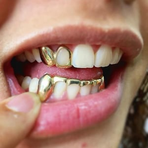Teeth Grill