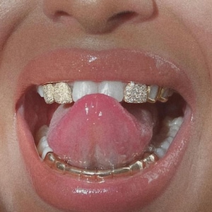 GOLD TEETH GRILL, Teeth Grill, Dental Teeth Grill, Dipped Silver Teeth Grill, Gold Silver Teeth Accessories, Gift For Dental