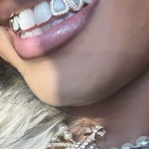 Griglie per denti