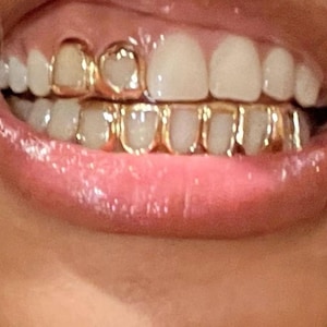 BOLD STATEMENT GRILL, Teeth Grill, Dental Grill, Eye Catching Grill, Dipped Silver Bold Gold Statement Teeth Grill, Teeth Accessories