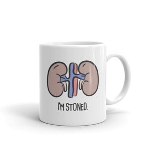 Kidney Stones Surgery Gift / Funny Kidney Stones Mug – &quot;Stoned&quot;