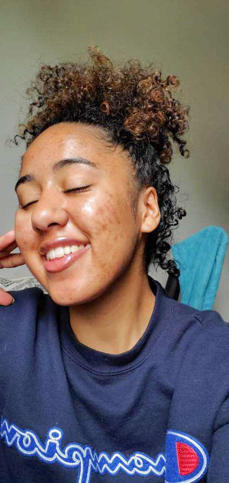 May include: A person with curly brown hair smiles with their eyes closed. They are wearing a navy blue Champion sweatshirt. The person's skin has some discoloration. A blue towel is visible in the background.