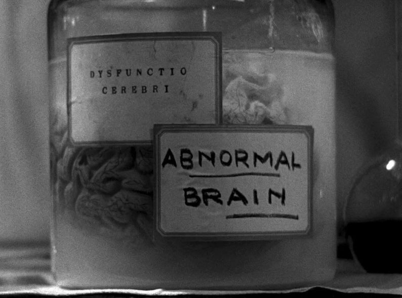 Abnormal Brain 2.5