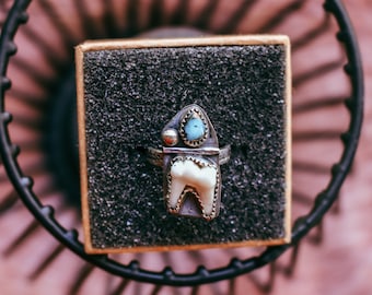 Tooth & Turquoise Silver Ring /Fox Molar Tooth/Teeth Jewelry/Sterling Silver Ring /Statement Ring /Real Tooth Ring/Oxidized Silver/Unique