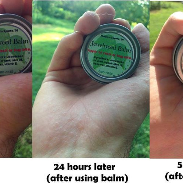 Jewel Weed Salve -Jewelweed Balm