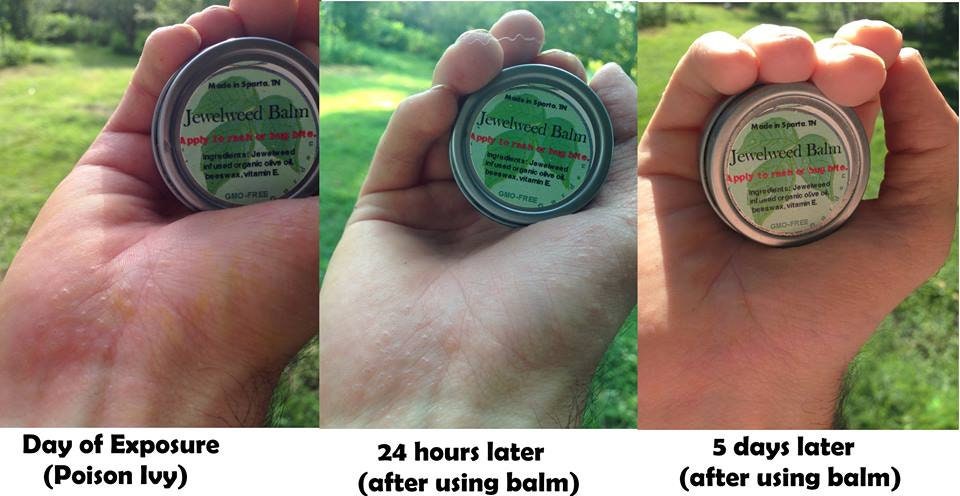 Jewel Weed Salve -Jewelweed Balm