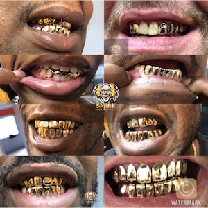 May include: A collage of eight images showcasing different styles of gold teeth grills. Each image features a close-up of a person's mouth with the grill in place. The grills are made of gold and have various designs, including diamond-shaped, rectangular, and curved shapes.