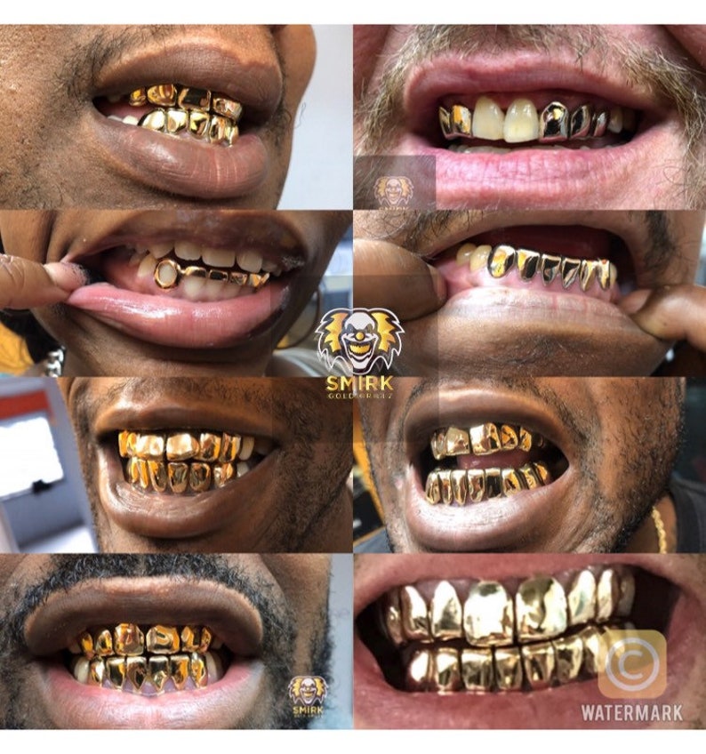 May include: A collage of eight images showcasing different styles of gold teeth grills. Each image features a close-up of a person's mouth with the grill in place. The grills are made of gold and have various designs, including diamond-shaped, rectangular, and curved shapes.