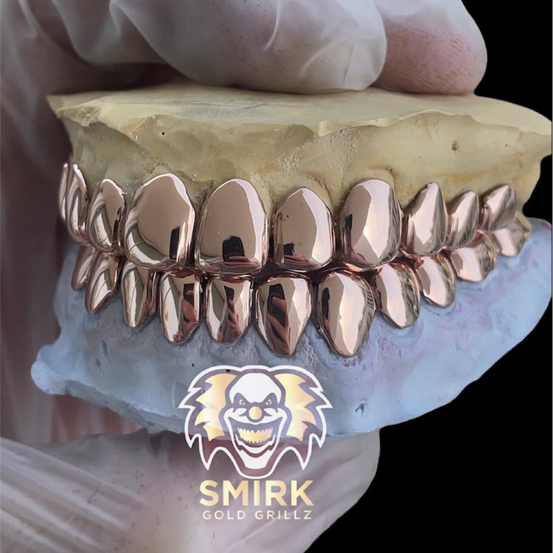 May include: Close-up of a gold grillz, a type of dental jewelry, made of rose gold. The grillz are set in a mold, showing the individual teeth.