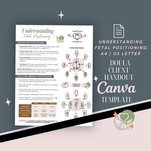 Document à distribuer sur le tableau de la position fœtale | Guide de positionnement optimal du fœtus | Éducation des clients de Doula | Modèle PDF modifiable