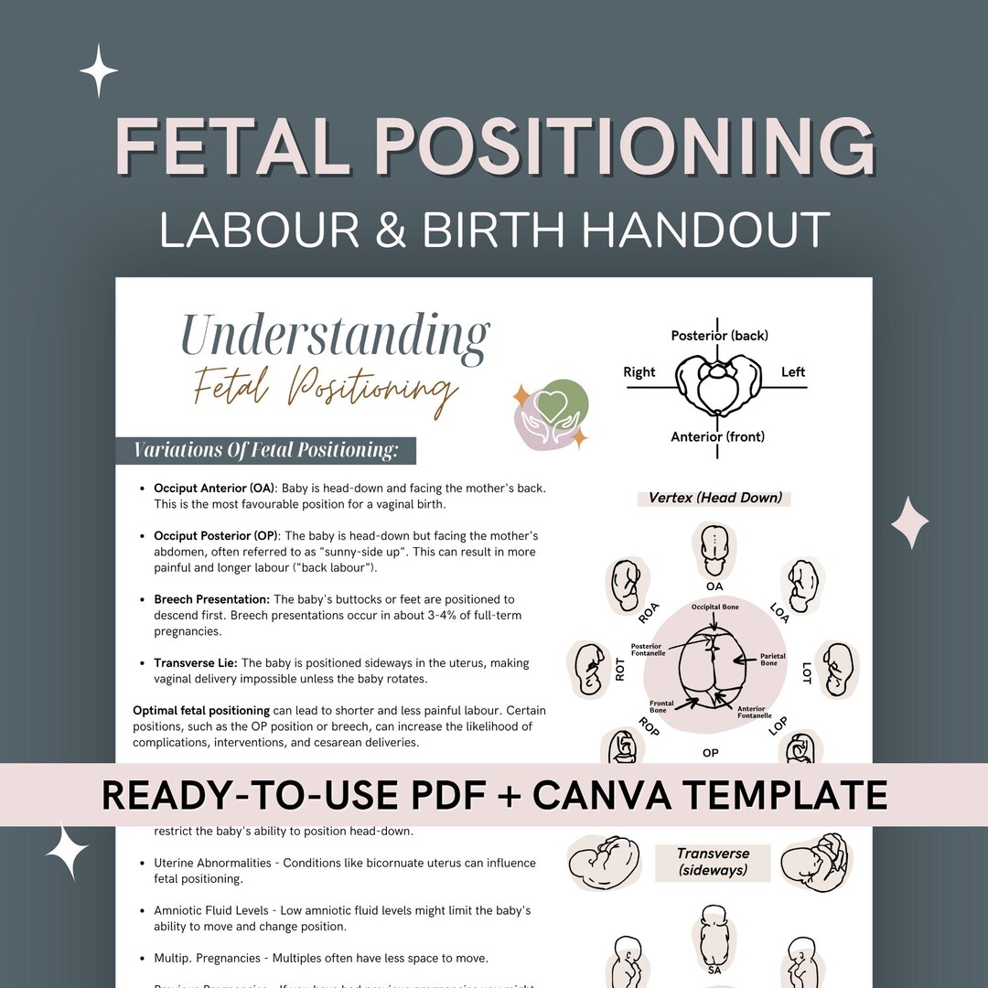 Fetal Position Chart Handout: Canva Template PDF Evidence