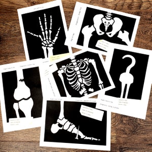 Könnte beinhalten: Ein Satz druckbarer Halloween-Röntgenbilder. Jedes Bild zeigt einen anderen Knochen, wie Hand, Knie, Fuß, Brustkorb und Hüfte. Die Bilder sind mit dem Körperteil und einer humorvollen Diagnose beschriftet, wie "Diagnose: Wackelige Hüfte" und "Diagnose: Auf einen Nagel aufgespießt".