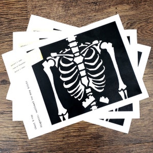 Puede incluir: Una imagen de rayos X en blanco y negro de un esqueleto humano con el texto "Chest X-ray Diagnosis: swallowed too many bricks" impreso debajo de la imagen.