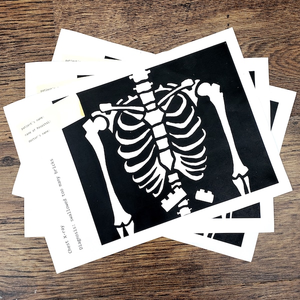 X-ray film of the chest for kids - for pretend doctors and nurses emergency treatment. PDF printable download.