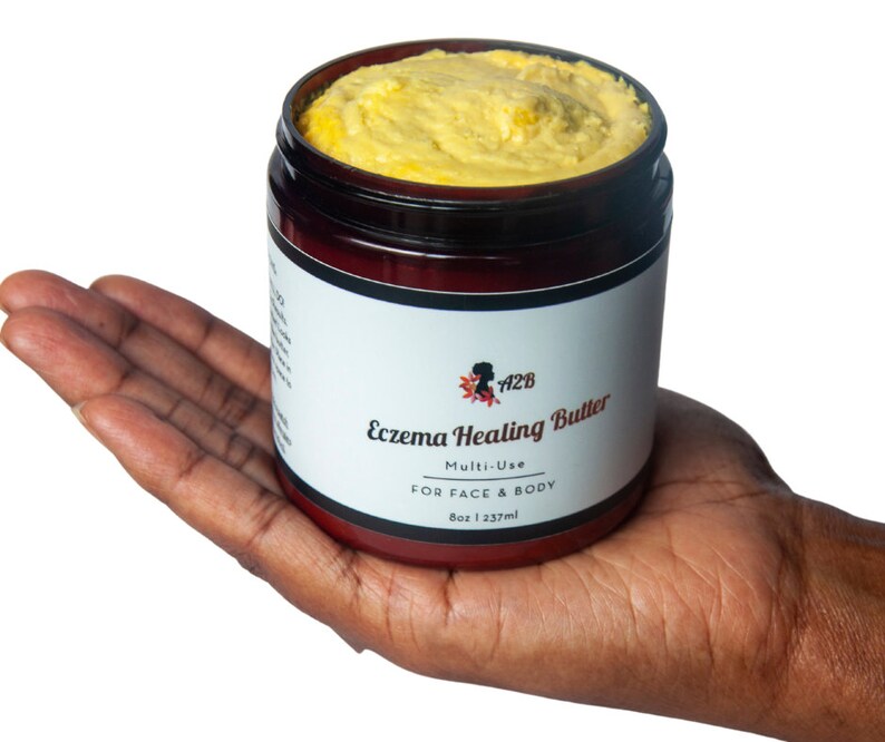 Eczema Healing Butter Psoriasis Rosacea Relieves Itch Etsy