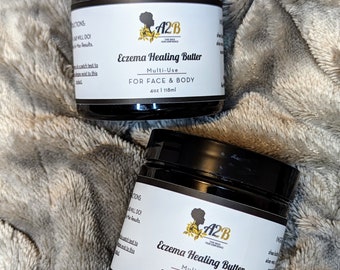 Eczema Butter | Psoriasis | Rosacea | Multi-Use | Face & Body