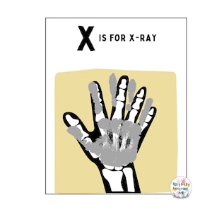 X es para plantilla de huella de mano de rayos X / Letra X / Manualidad del alfabeto para hacer uno mismo / Actividad preescolar / Manualidad para niños pequeños / Impresión artística para maestros / Educación en el hogar