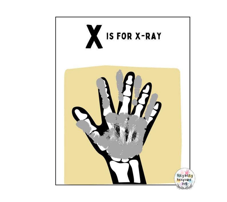 X Is For X Ray Handprint Art Template Letter X Craft Digital Download