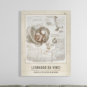 Leonardo da Vinci Acrylic Glass Print | Studies Of The Foetus In The Womb  | Leonardo da Vinci Acrylic Poster | da Vinci Acrylic Glass Decor