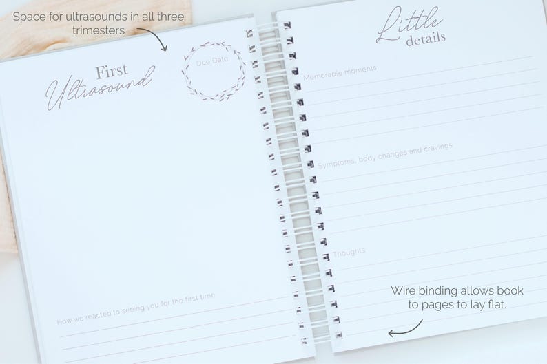 Pregnancy Journal | Pregnancy Book | Pregnancy Album| Expecting Mom Gift | Baby Shower | New Mom Gift | Pregnancy Gift | Baby Journal | Baby Keepsake