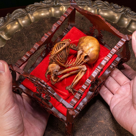 Baby Fetus Infant 3D Printed Skeleton in Cradle, Hand Painted