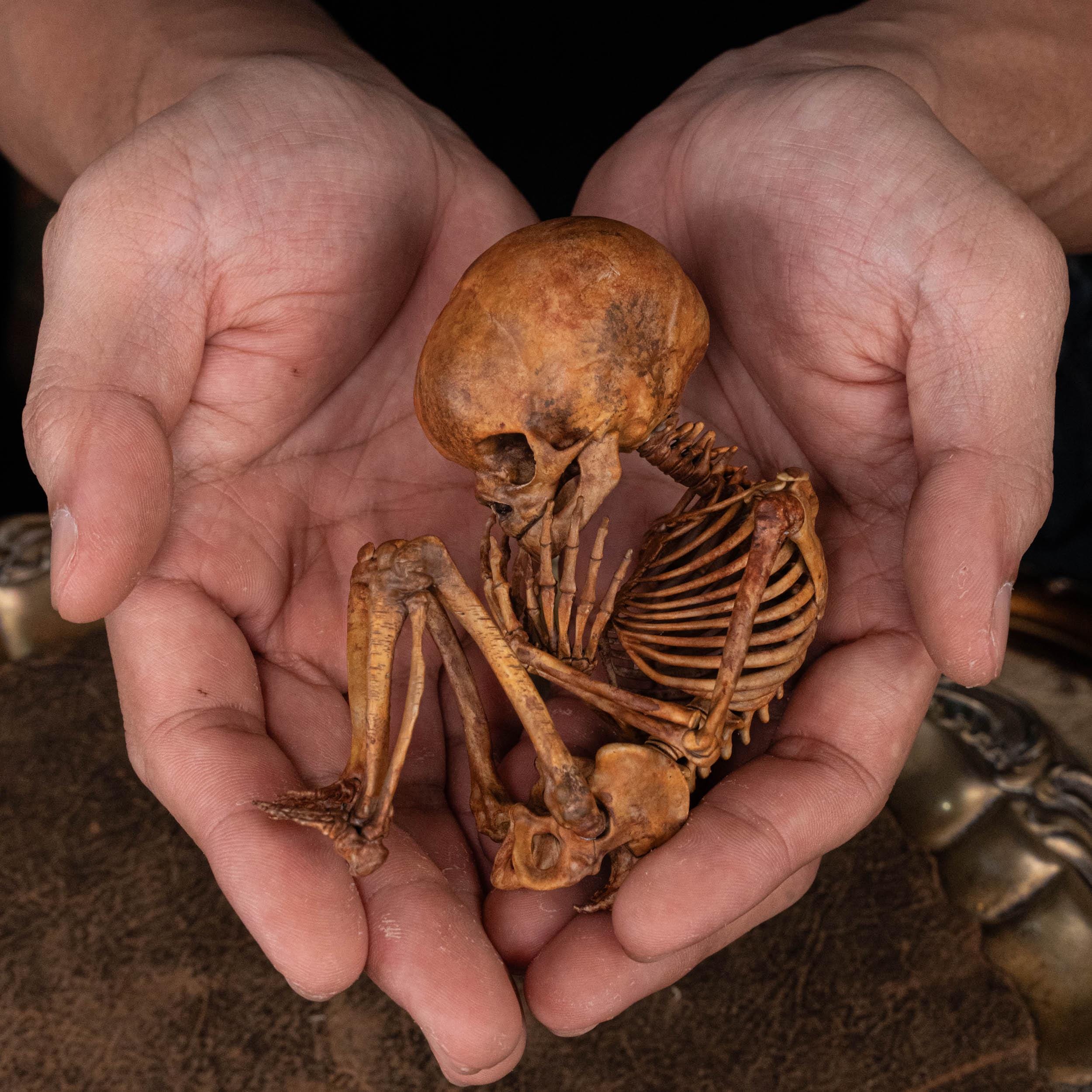 Human Baby Skeleton Fetus 3D Printed on Vintage Victorian Frame