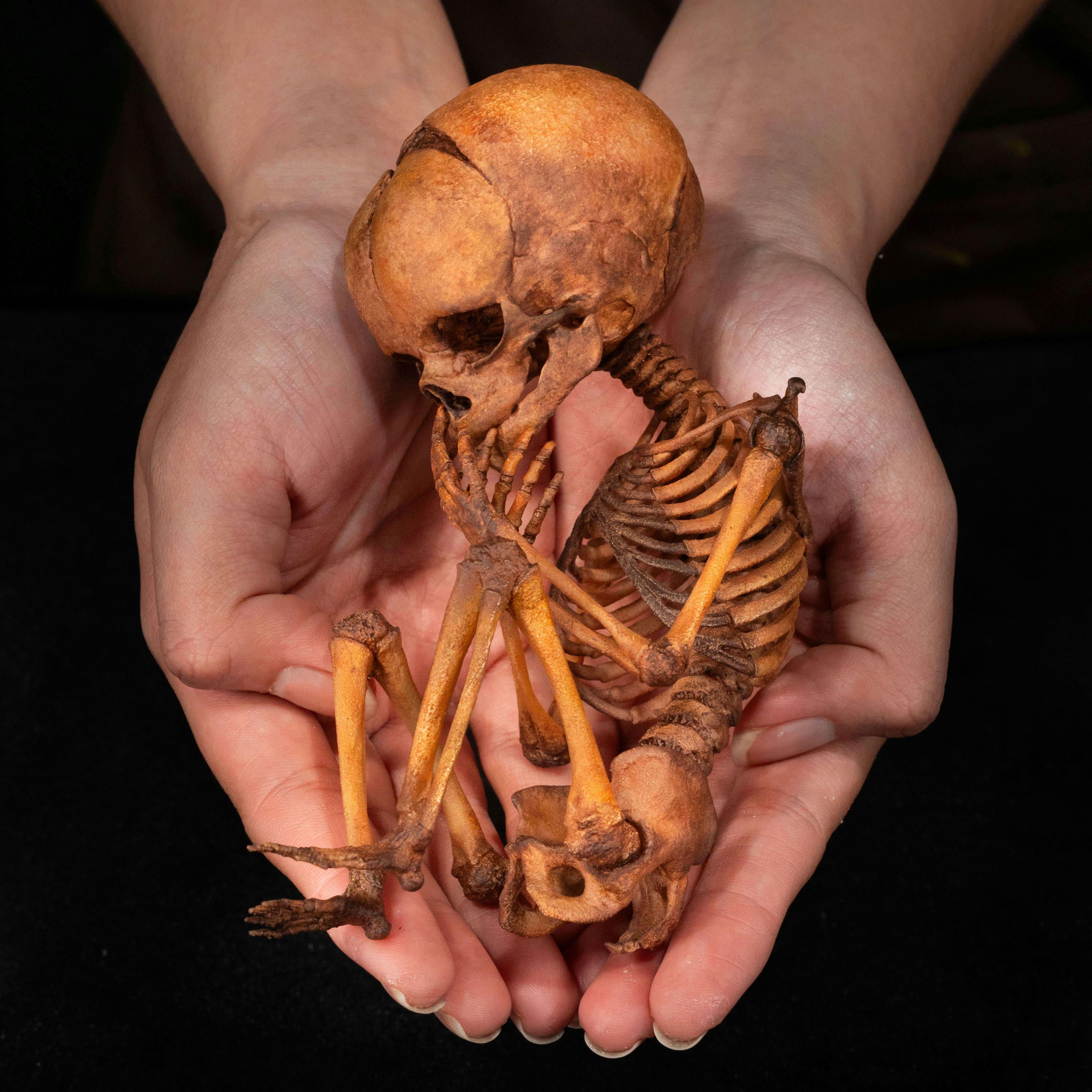 Human Fetus Skeleton Wall Art, Hand-painted 3D Printed Anatomical
