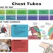 Critical Care CHEST TUBES Everything You Need to Know 15 Pages - Etsy