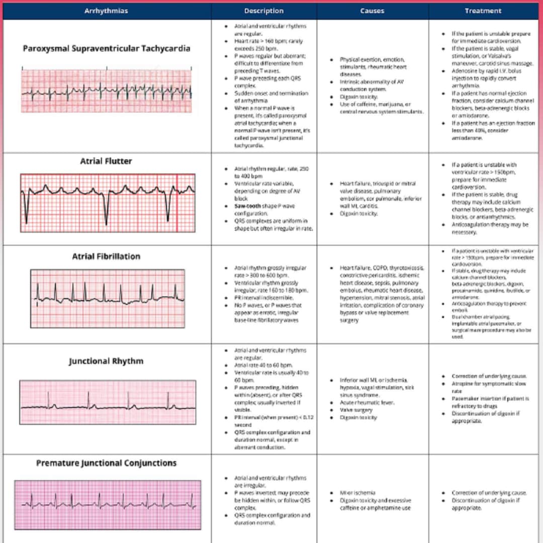 Basic ekg interpretation 3 pages long printable pdf etsy ireland