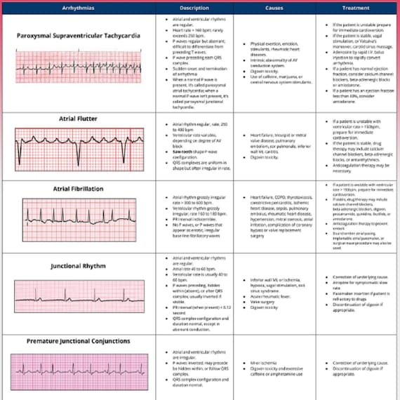 basic-ekg-interpretation-3-pages-long-printable-pdf-etsy