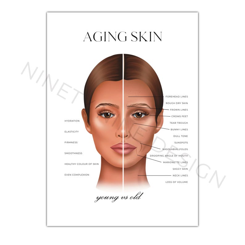 Aging Skin Diagram Poster | Young Vs Old | Aesthetics Practitioner Wall ...