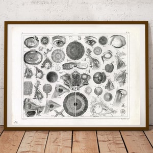 May include: A black and white anatomical illustration of the human eye. The image shows various cross-sections and close-ups of the eye, including the iris, pupil, lens, and retina.