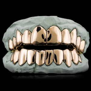 Solid Gold Grillz