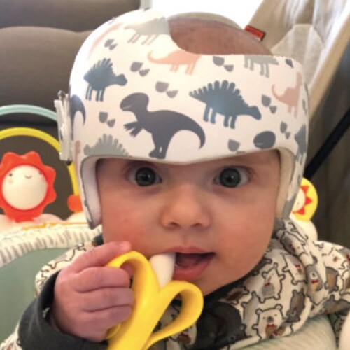 Cranial Band Decal Baby Helmet Decal Baby Helmet Wrap Etsy