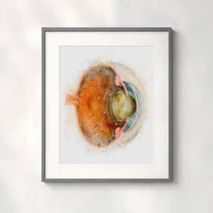 Eye Doctor Gift, Cataract Eye Cross Section Watercolor Style Art Print Eye Doctor Office Decor - 035