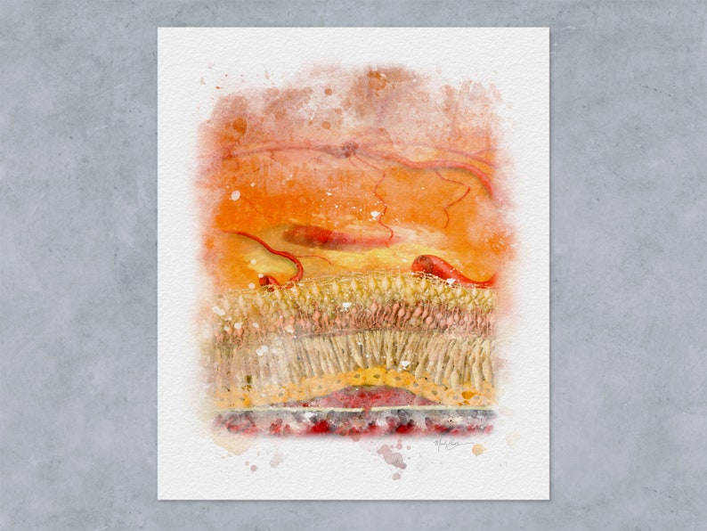 Macular Degeneration Watercolor Style Art Print for Eye Doctor Office Decor 208 Retina Doctor Gift