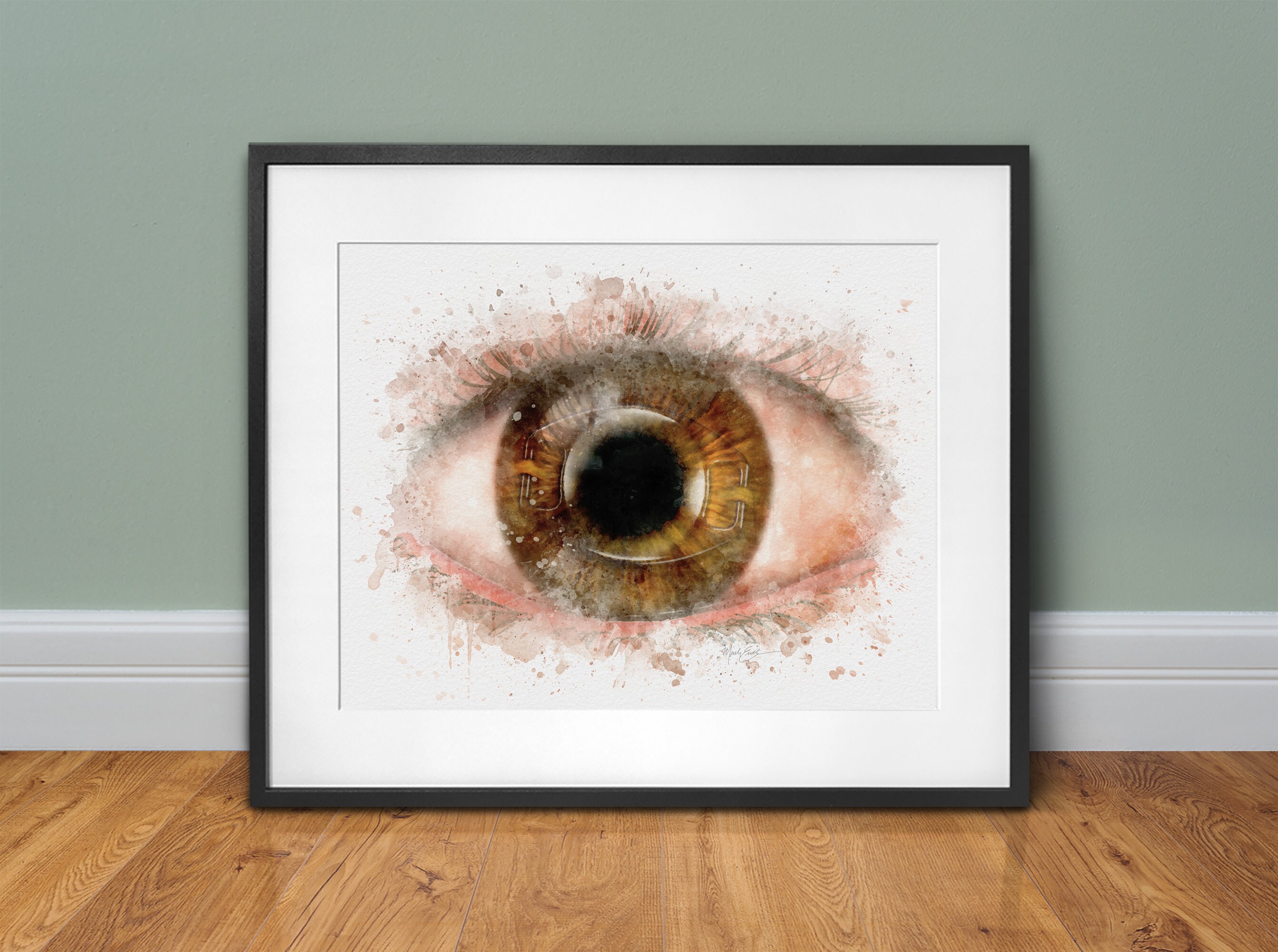 Iris fixated intraocular lens art print, ophthalmologist gift, watercolor style eye doctor's office décor ophthalmologist gift - 093