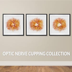 May include: A set of three square framed prints featuring watercolor illustrations of the optic nerve. Each print displays a circular orange and red anatomical structure on a white background. The text OPTIC NERVE CUPPING COLLECTION is centered below.