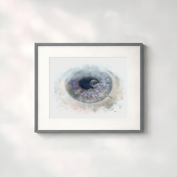 Eye surgeon gift, DMEK eye doctor art print watercolor style eye surgeon wall décor, ophthalmology gift, cornea doctor gift - 056