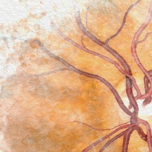 Med student gift, retina artwork, for ophthalmology medical student graduate